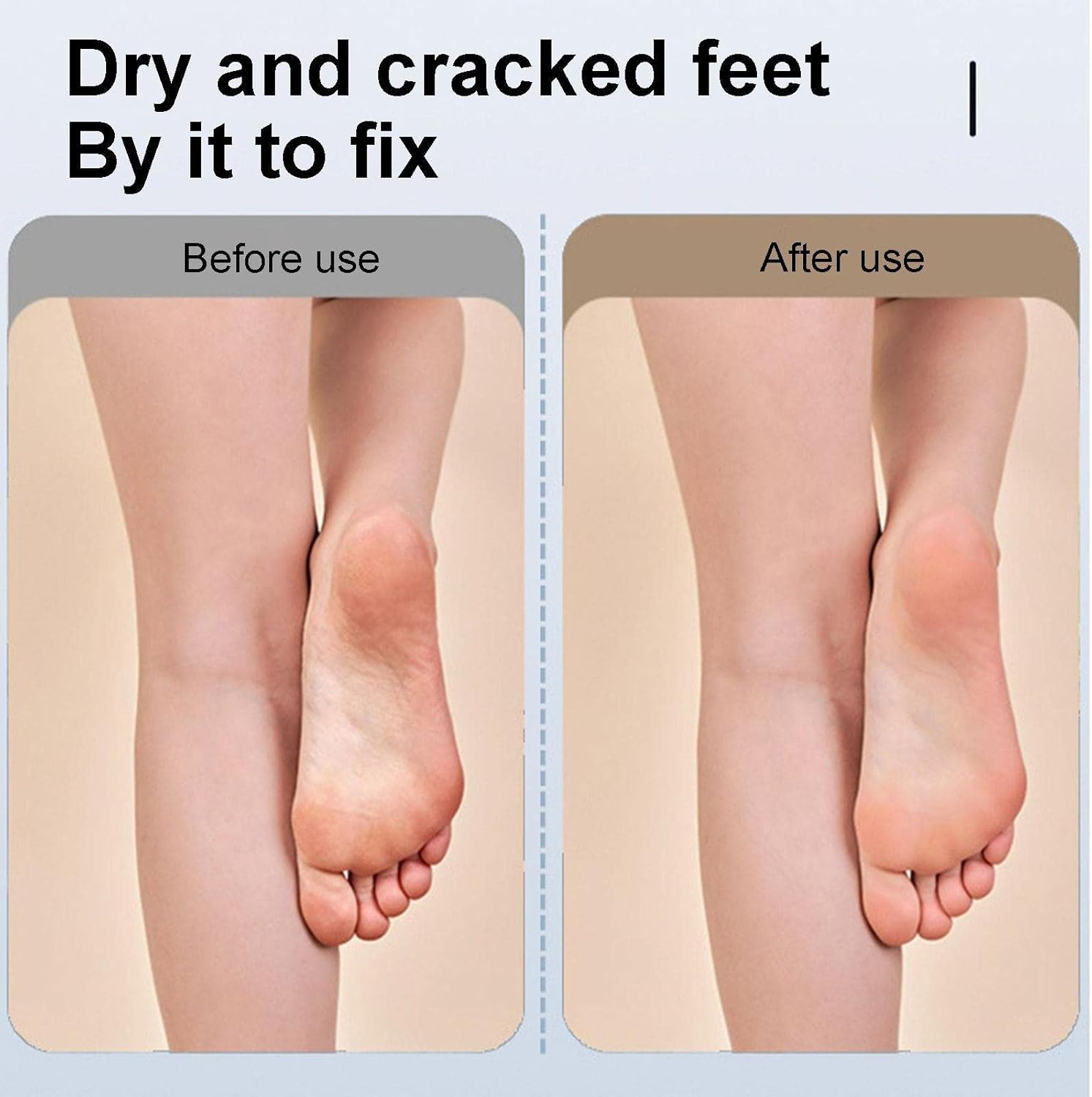 Electric Callus Remover for feet, Rechargeable Waterproof Foot File, Dead Skin Foot Care Callus Remover - Rechargeable Waterproof Foot File